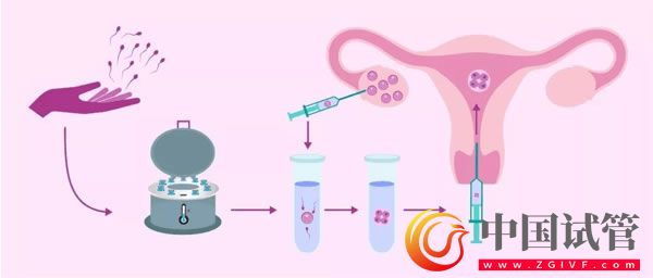 第四代试管婴儿(图3) 第四代试管婴儿(图3)