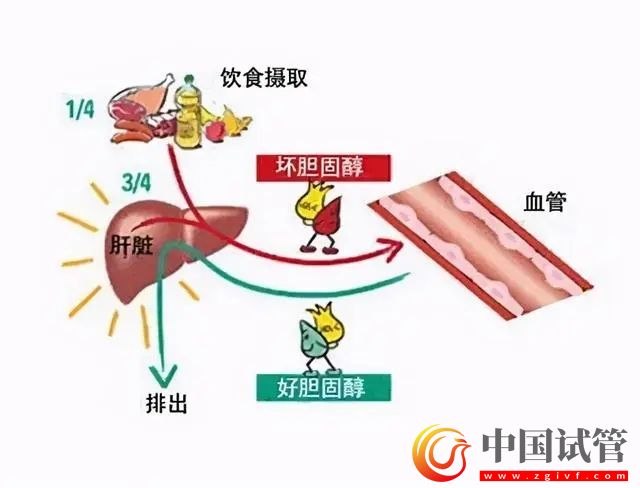 首款针对“坏胆固醇”的口服药问世(图1) 首款针对“坏胆固醇”的口服药问世(图1)