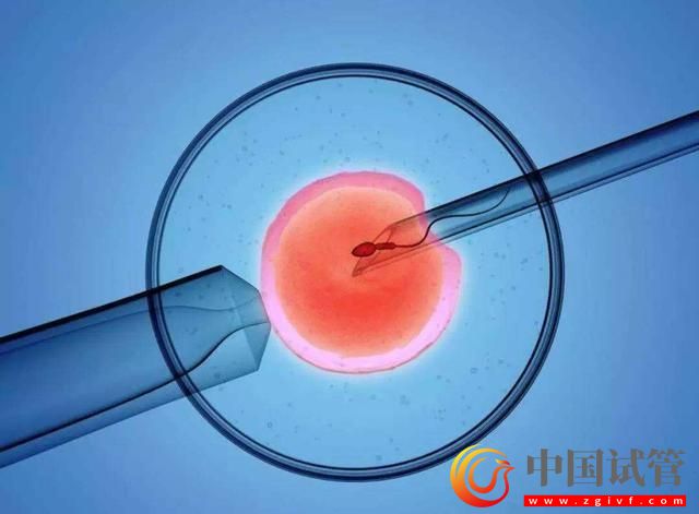玉树做试管多少钱?(图1) 玉树做试管多少钱?(图1)