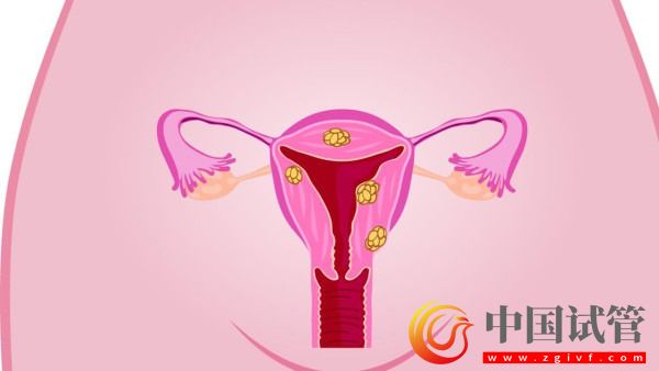 北京宫颈癌与乳腺癌早诊治疗率接近100%(图1) 北京宫颈癌与乳腺癌早诊治疗率接近100%(图1)