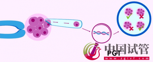 什么是PGT、PGS和PGD?(图2) 什么是PGT、PGS和PGD?(图2)