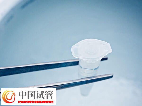 重庆大坪医院单次试管婴儿开销分享,全程差不多5w(图1) 重庆大坪医院单次试管婴儿开销分享,全程差不多5w(图1)