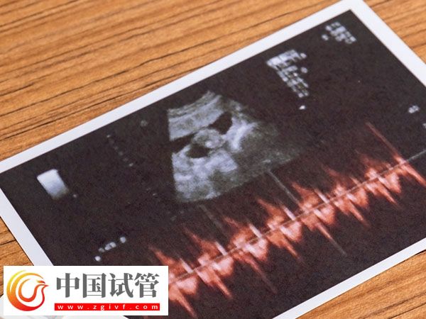 杭州正规促排医院排名公布,浙江省妇保医院综合第一(图1) 杭州正规促排医院排名公布,浙江省妇保医院综合第一(图1)