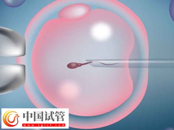 49岁高龄做试管婴儿易生化,染色体异常是主要原因(图2) 49岁高龄做试管婴儿易生化,染色体异常是主要原因(图2)