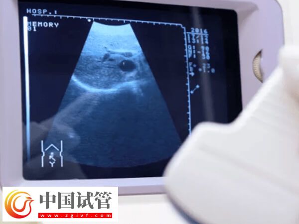 2024柳州试管婴儿排名上线,市妇幼勇夺榜首(图1) 柳州试管婴儿排名上线,市妇幼勇夺榜首(图1)