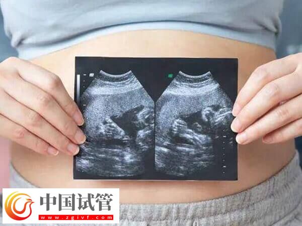 怀双胞胎的产前准备有哪些(图1) 怀双胞胎的产前准备有哪些(图1)