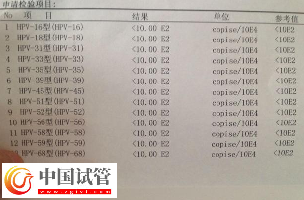 通过hpv报告单图片怎么判断自己是正常的呢?(图1) 通过hpv报告单图片怎么判断自己是正常的呢?(图1)
