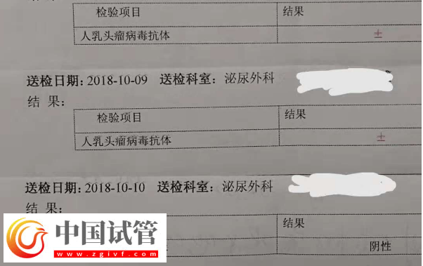 通过hpv报告单图片怎么判断自己是正常的呢?(图2) 通过hpv报告单图片怎么判断自己是正常的呢?(图2)