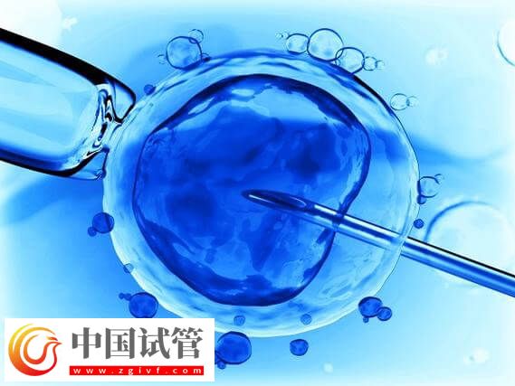 长沙试管婴儿平均成功率高达65%,满足这三个条件即可申请(图3) 长沙试管婴儿平均成功率高达65%,满足这三个条件即可申请(图3)