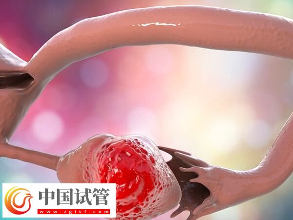试管婴儿也有弊端,提前了解各阶段注意事项可减少风险(图2) 试管婴儿也有弊端,提前了解各阶段注意事项可减少风险(图2)