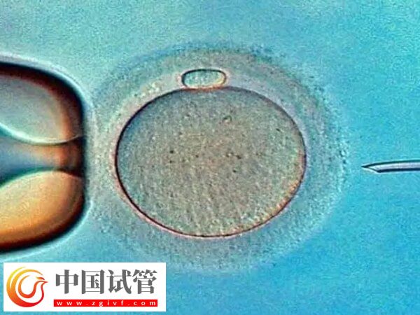 广州市第一人民医院试管婴儿价格,养囊4千起(图1) 广州市第一人民医院试管婴儿价格,养囊4千起(图1)