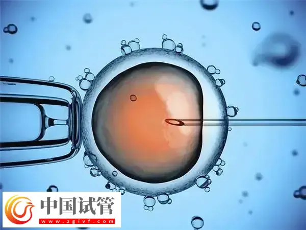 山西省儿童医院试管婴儿哪个医生成功率高(图1) 山西省儿童医院试管婴儿哪个医生成功率高(图1)