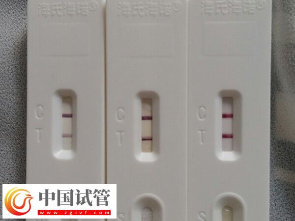 青岛妇女儿童医院助孕科普,内附开展项目及成功率(图3) 青岛妇女儿童医院助孕科普,内附开展项目及成功率(图3)