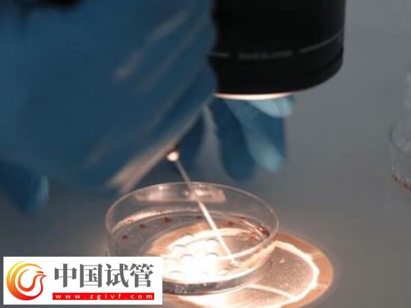 嵌合体30%其实也可以做试管婴儿移植,比例才是成功关键(图1) 嵌合体30%其实也可以做试管婴儿移植,比例才是成功关键(图1)
