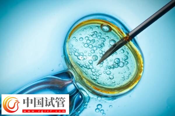 同性恋可不可以做试管婴儿生龙凤胎(图1) 同性恋可不可以做试管婴儿生龙凤胎(图1)
