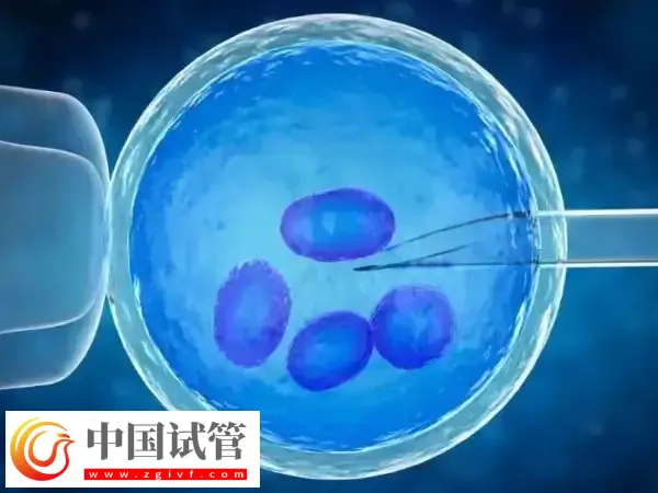 输卵管积水可不可以移植胚胎(图1) 输卵管积水可不可以移植胚胎(图1)