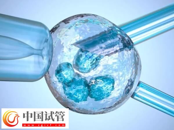 试管婴儿移植后需不需要大补(图1) 试管婴儿移植后需不需要大补(图1)
