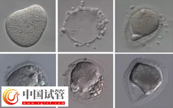 为什么二代试管婴儿还会出现受精失败(图1) 为什么二代试管婴儿还会出现受精失败(图1)