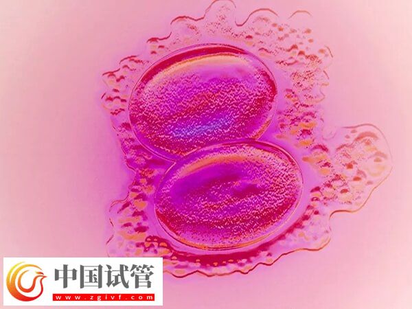 只移植一个胚胎怎么还会怀上双胞胎(图1) 只移植一个胚胎怎么还会怀上双胞胎(图1)