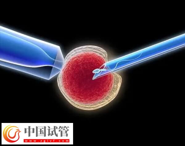 做试管婴儿出现腹水的原因是什么(图1) 做试管婴儿出现腹水的原因是什么(图1)
