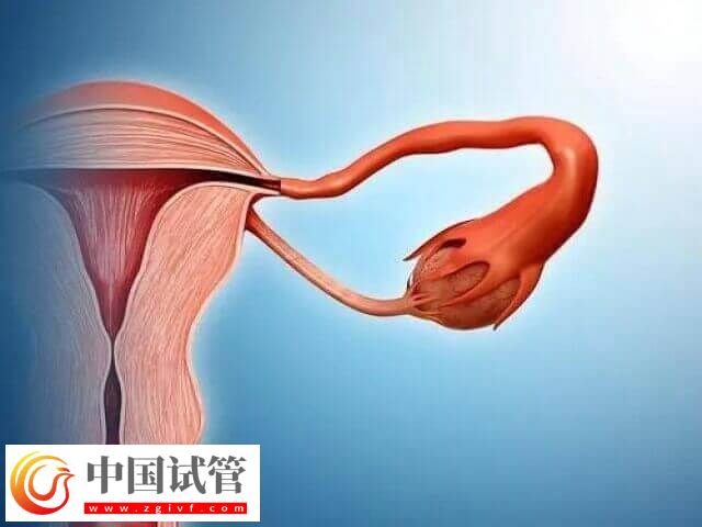 子宫偏小对试管婴儿的影响有哪些(图1) 子宫偏小对试管婴儿的影响有哪些(图1)