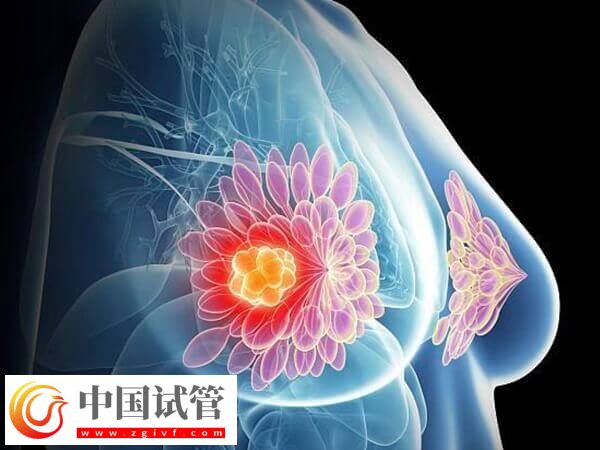 移植后乳房越来越软的原因是什么(图1) 移植后乳房越来越软的原因是什么(图1)