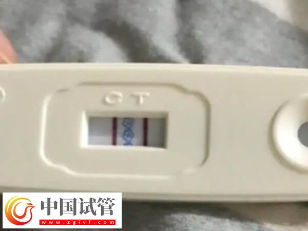 试管婴儿取卵要适当饮用蛋白粉,对内膜恢复有积极作用!(图1) 试管婴儿取卵要适当饮用蛋白粉,对内膜恢复有积极作用!(图1)