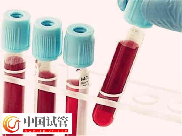 四维彩超怎么判断双胞胎是不是龙凤胎(图1) 四维彩超怎么判断双胞胎是不是龙凤胎(图1)