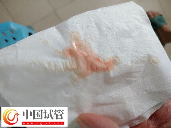 试管婴儿取卵后月经不调怎么回事(图1)