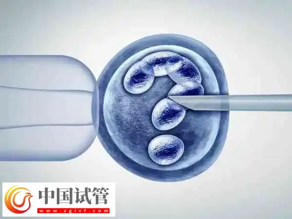 昆明做供卵试管婴儿有什么要求(图1) 昆明做供卵试管婴儿有什么要求(图1)