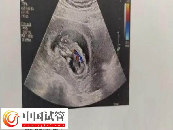 唐山做人工授精有哪些步骤(图1) 唐山做人工授精有哪些步骤(图1)