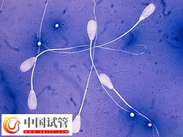 赤峰供精人授成功率多少(图1) 赤峰供精人授成功率多少(图1)