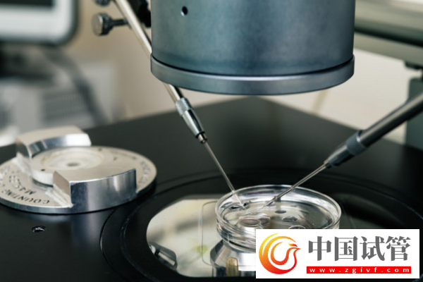 试管婴儿移植最佳时间是什么时候?揭秘科学安排的重要性!(图1) 试管婴儿移植最佳时间是什么时候?揭秘科学安排的重要性!(图1)