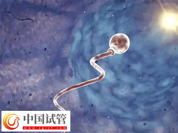 男性有精囊炎做试管婴儿要检查什么项目(图1) 男性有精囊炎做试管婴儿要检查什么项目(图1)