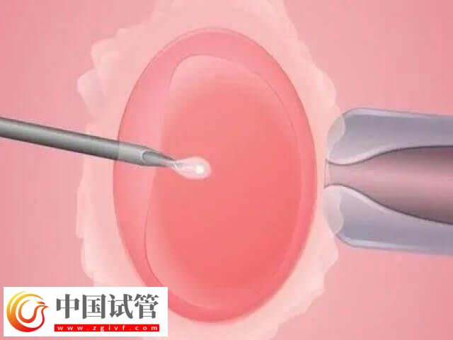 大同三院试管步骤有哪些(图1) 大同三院试管步骤有哪些(图1)