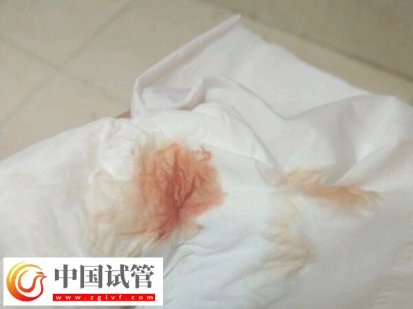 移植着床会有什么反应(图1) 移植着床会有什么反应(图1)