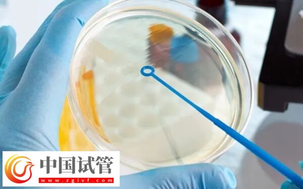 不能移鲜胚什么原因(图1) 不能移鲜胚什么原因(图1)