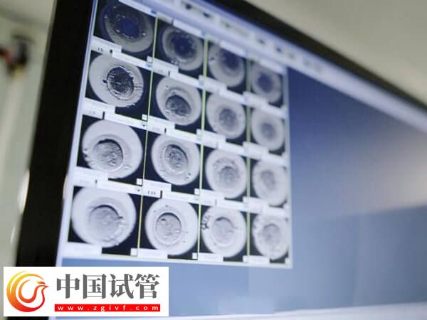 胚胎8细胞好还是9细胞好(图1) 胚胎8细胞好还是9细胞好(图1)