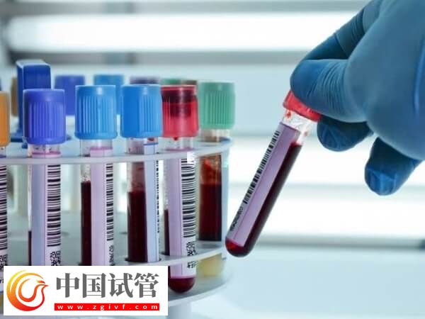 做试管前要做什么检查(图1) 做试管前要做什么检查(图1)