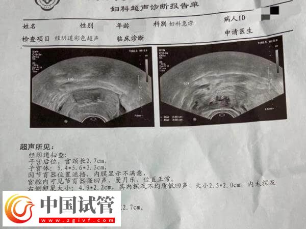 试管移植后一超二超三超时间多久(图1) 试管移植后一超二超三超时间多久(图1)
