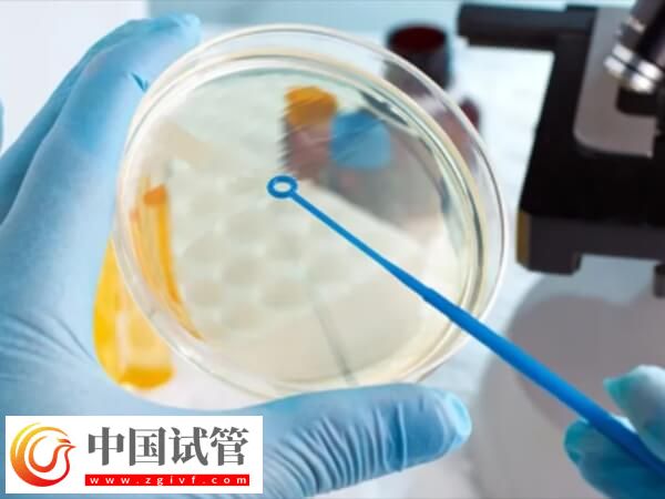 试管婴儿建档后流程是怎么样的(图1) 试管婴儿建档后流程是怎么样的(图1)