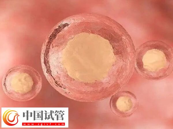 试管婴儿是不是取卵越多越好(图1) 试管婴儿是不是取卵越多越好(图1)