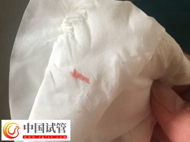 试管移植后着床有什么反应(图1) 试管移植后着床有什么反应(图1)