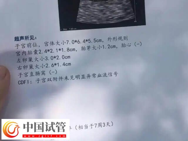 试管移植成功为什么会胎停(图1) 试管移植成功为什么会胎停(图1)