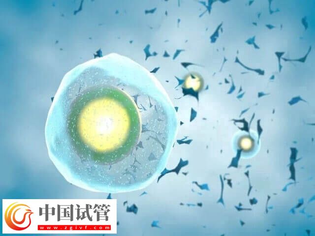 试管移植宫外孕有没有感觉(图1) 试管移植宫外孕有没有感觉(图1)