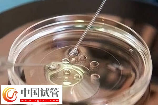 10个人做试管几个能成功(图1) 10个人做试管几个能成功(图1)