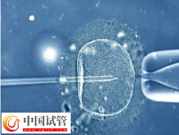 三代试管移植成功了要注意什么(图2) 三代试管移植成功了要注意什么(图2)