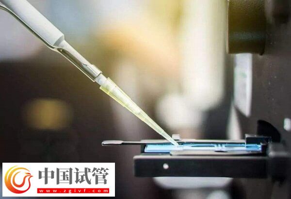 冻胚移植14天hcg300多正不正常(图2) 冻胚移植14天hcg300多正不正常(图2)