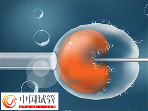 日照人民医院试管条件(图3) 日照人民医院试管条件(图3)