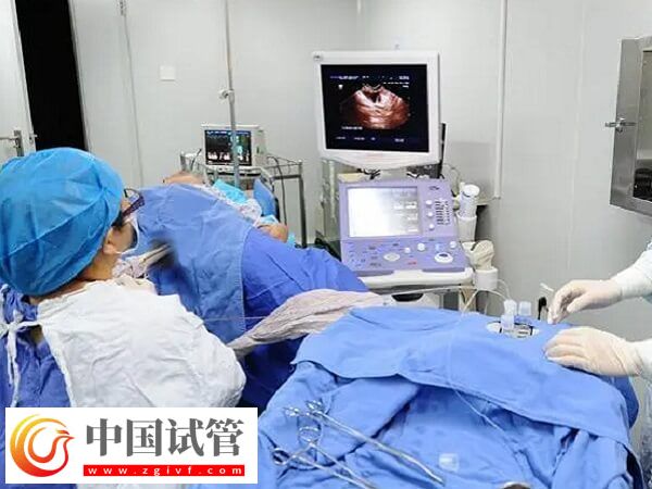 自然周期取卵前能不能同房(图1) 自然周期取卵前能不能同房(图1)